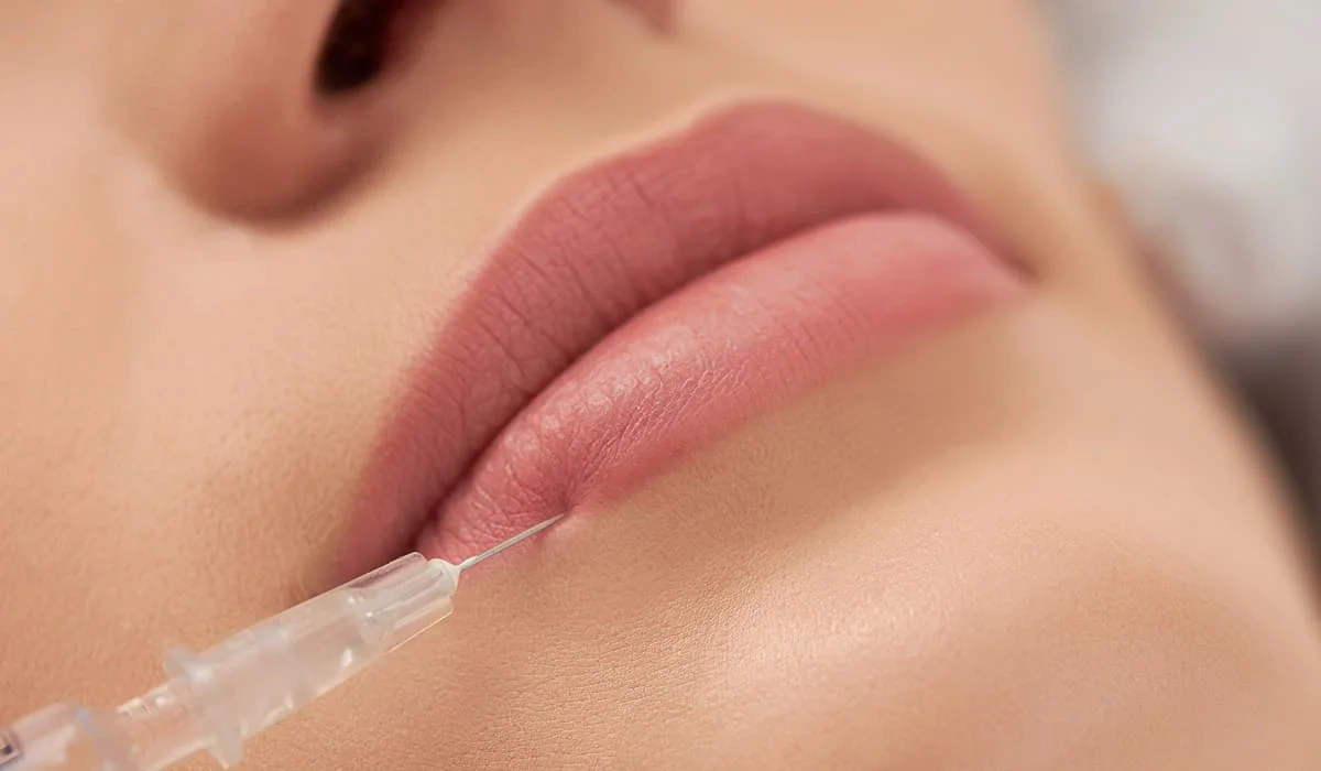 What Is a Lip Filler Treatment and How Does It Work?