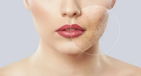 How the skin barrier works and protects the skin