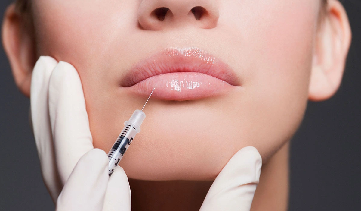 Exploring Lip Augmentation Options
