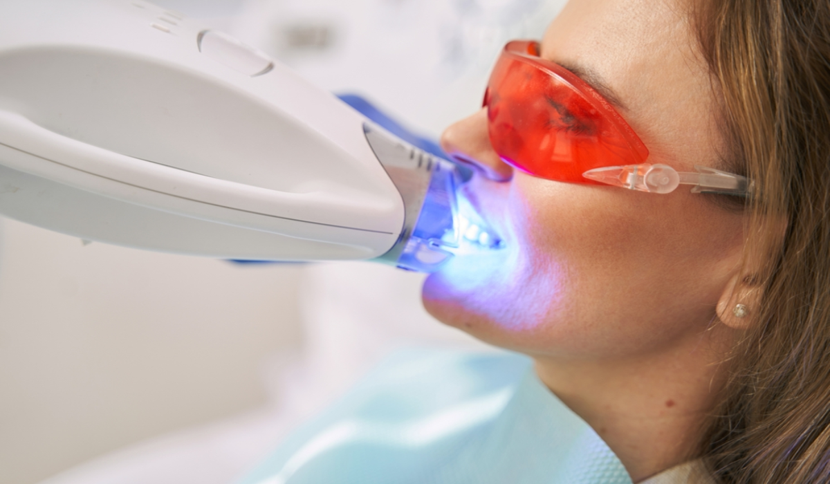 Are LED Teeth Whitening Kits Better?