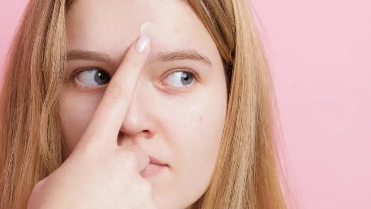 The Best Spot Treatments for Pimples in 2026